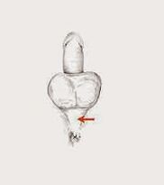 تقوية العضلات وشدها لزيادة قوتها